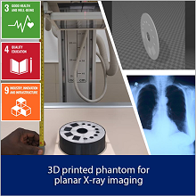 How 3D printing can help low-resourced X-ray departments