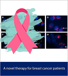 A novel therapy for breast cancer patients